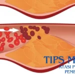 Tips Mudah Atasi Penyumbatan Pembuluh Darah!
